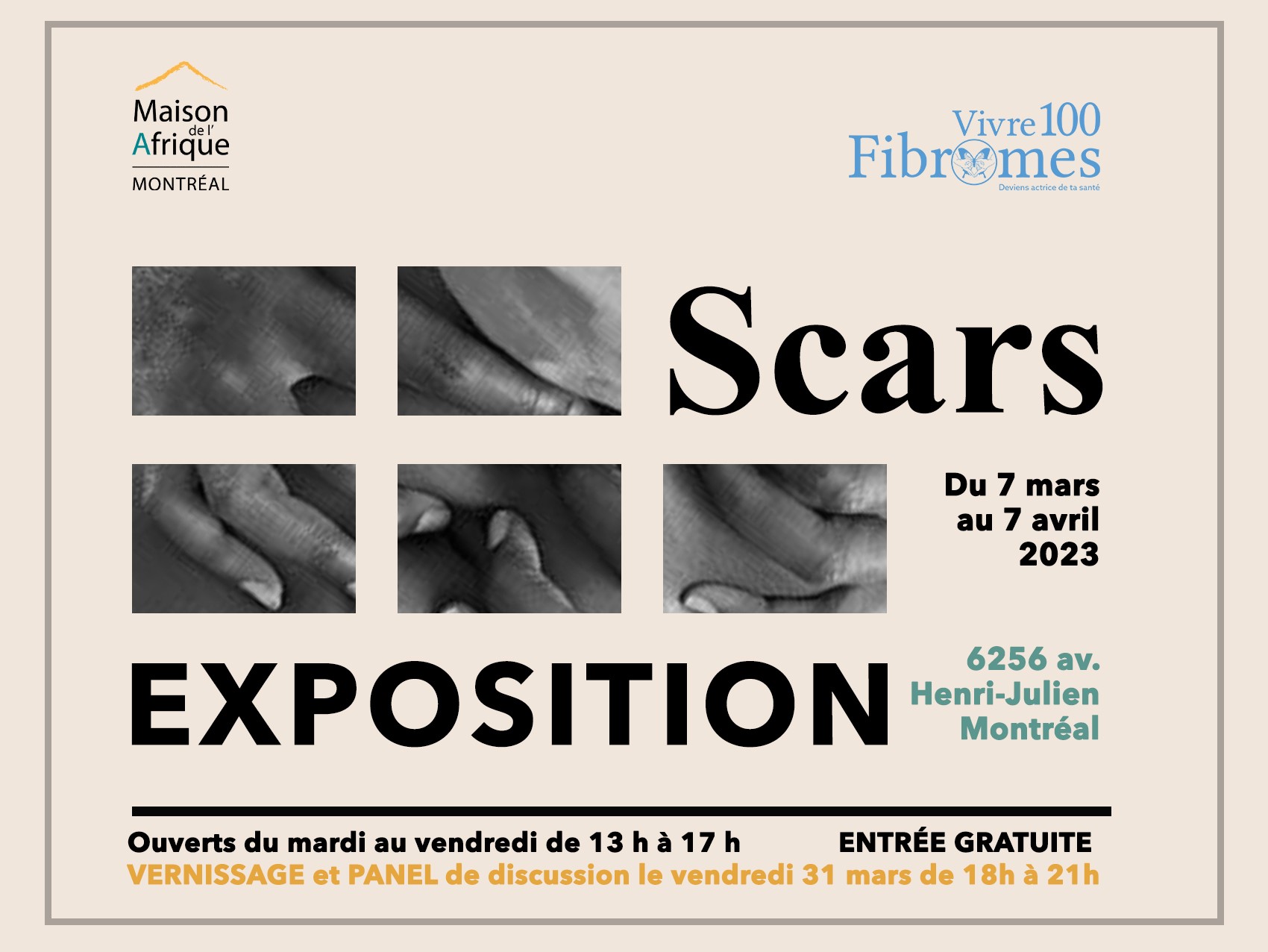 Vernissage de l’exposition Scars et Panel de discussion